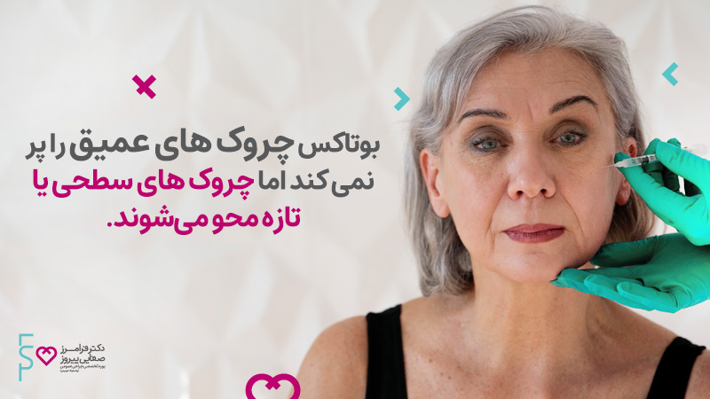 عملکرد بوتاکس